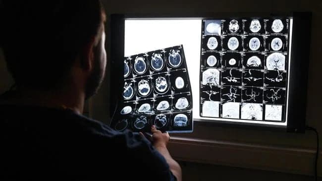 Диета и риск рассеянного склероза: что советует невролог